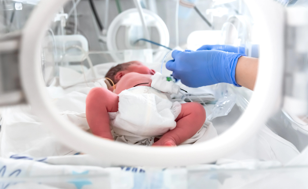 Filtration of Breast Milk for Premature Babies